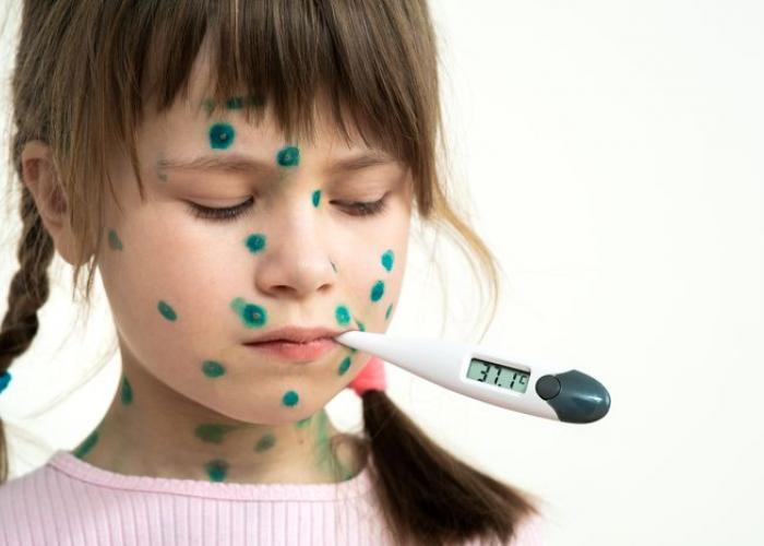 Dossier pour différencier les boutons chez l'enfant
