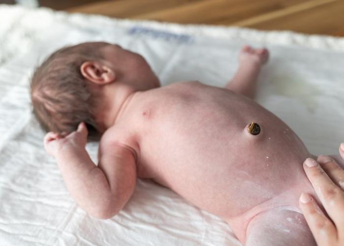 Photo de nombril d'un nourrisson avec un petit morceau de cordon ombilical