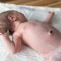 Photo de nombril d'un nourrisson avec un petit morceau de cordon ombilical