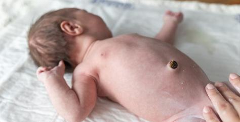 Photo de nombril d'un nourrisson avec un petit morceau de cordon ombilical
